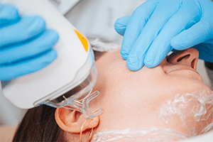 Laser skin resurfacing